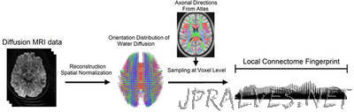 Researchers Develop Way To "Fingerprint" the Brain
