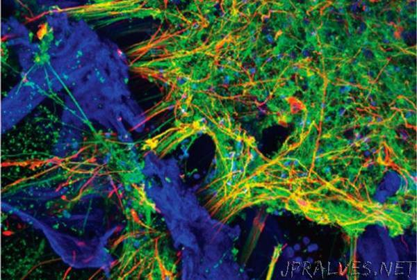 Tufts scientists grow functioning human neural networks in 3D from stem cells