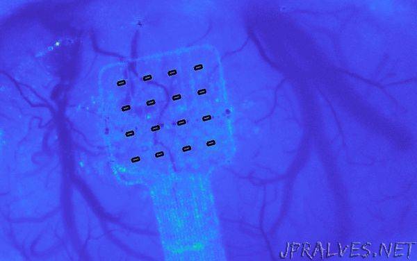 Graphene sensors can hear your brain whisper