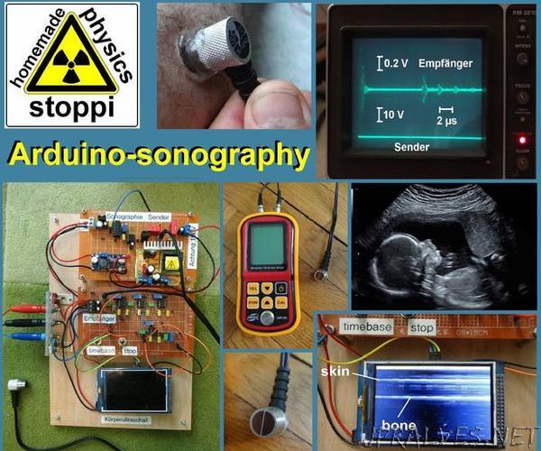 Body-ultrasound Sonography With Arduino