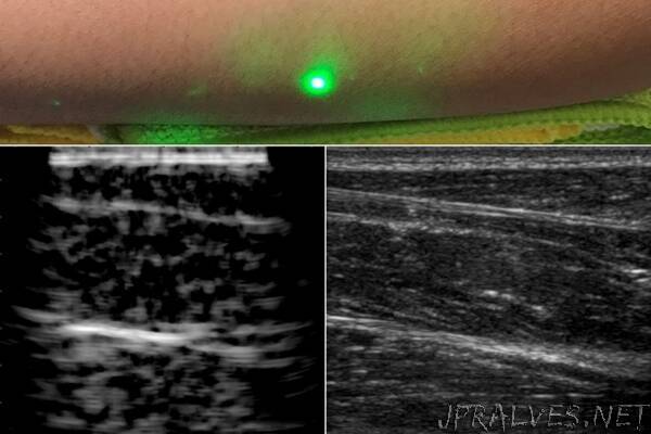 Researchers produce first laser ultrasound images of humans