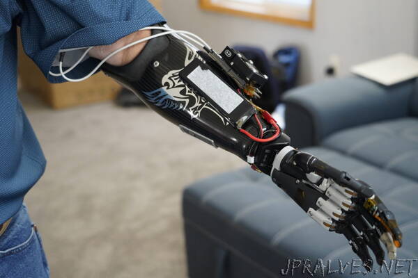First-Hand Experience: Deep Learning Lets Amputee Control Prosthetic Hand, Video Games