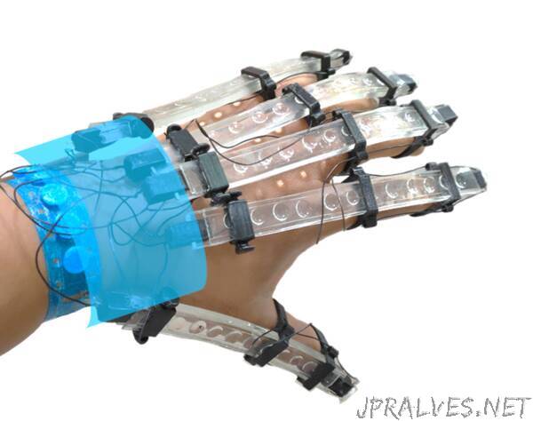 3D printed gloves for rehabilitating stroke patients