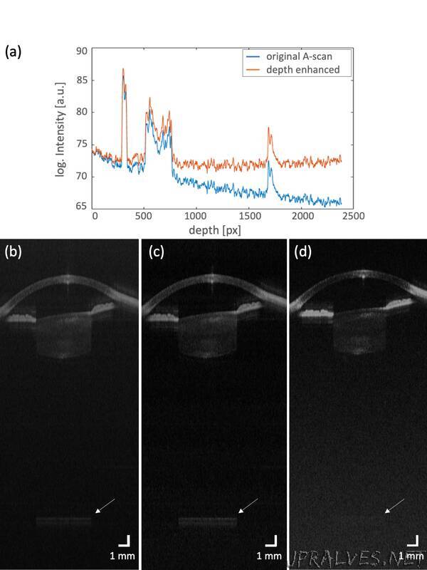 Technology advance lays groundwork for OCT eye imaging at home