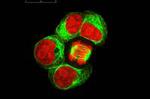 Gene circuits in live cells can perform complex computations