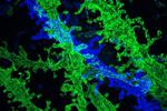 High-resolution imaging with conventional microscopes