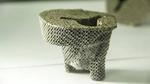 World-first: 3D printed tantalum knee joint implanted in a Chinese patient