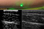Researchers produce first laser ultrasound images of humans