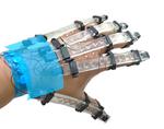 3D printed gloves for rehabilitating stroke patients